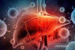 Fasilitas kesehatan di Surabaya antisipasi penyebaran hepatitis akut