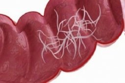 Eks Direktur WHO soroti pelajaran kasus anak di Sukabumi tubuhnya dipenuhi cacing