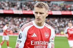 Martin Odegaard batal perkuat timnas Norwegia karena cedera