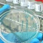 Kasus flu burung baru terdeteksi, Australia waspada penuh
